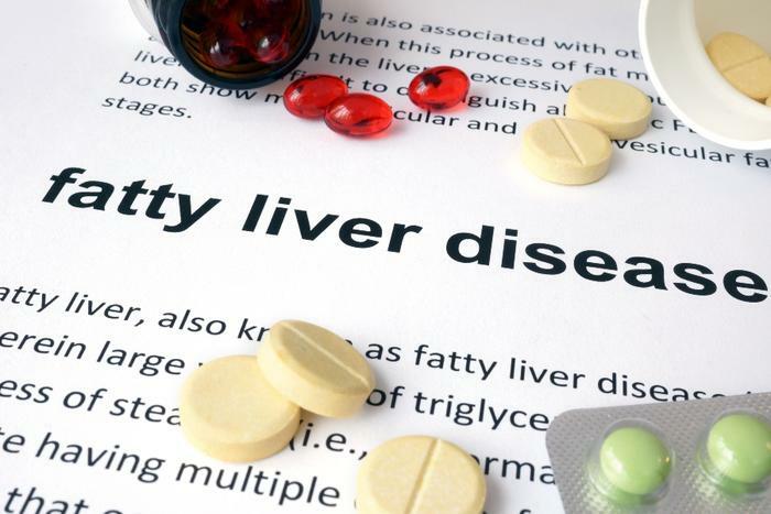 Fatty liver disease concept