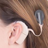Cochlear implants vs. hearing aids image