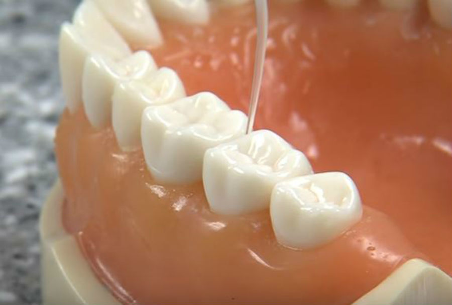 Researchers say a new drillfree cavity treatment may soon be available