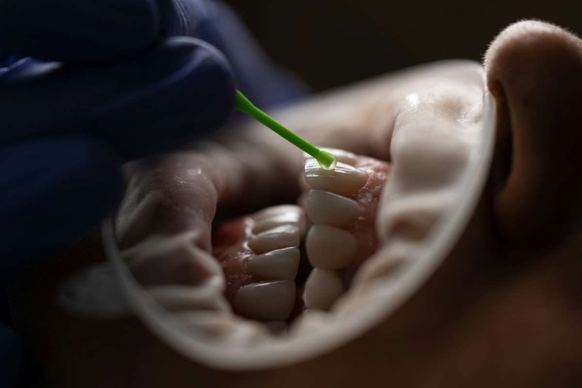 Losing teeth happens more in these U.S. states