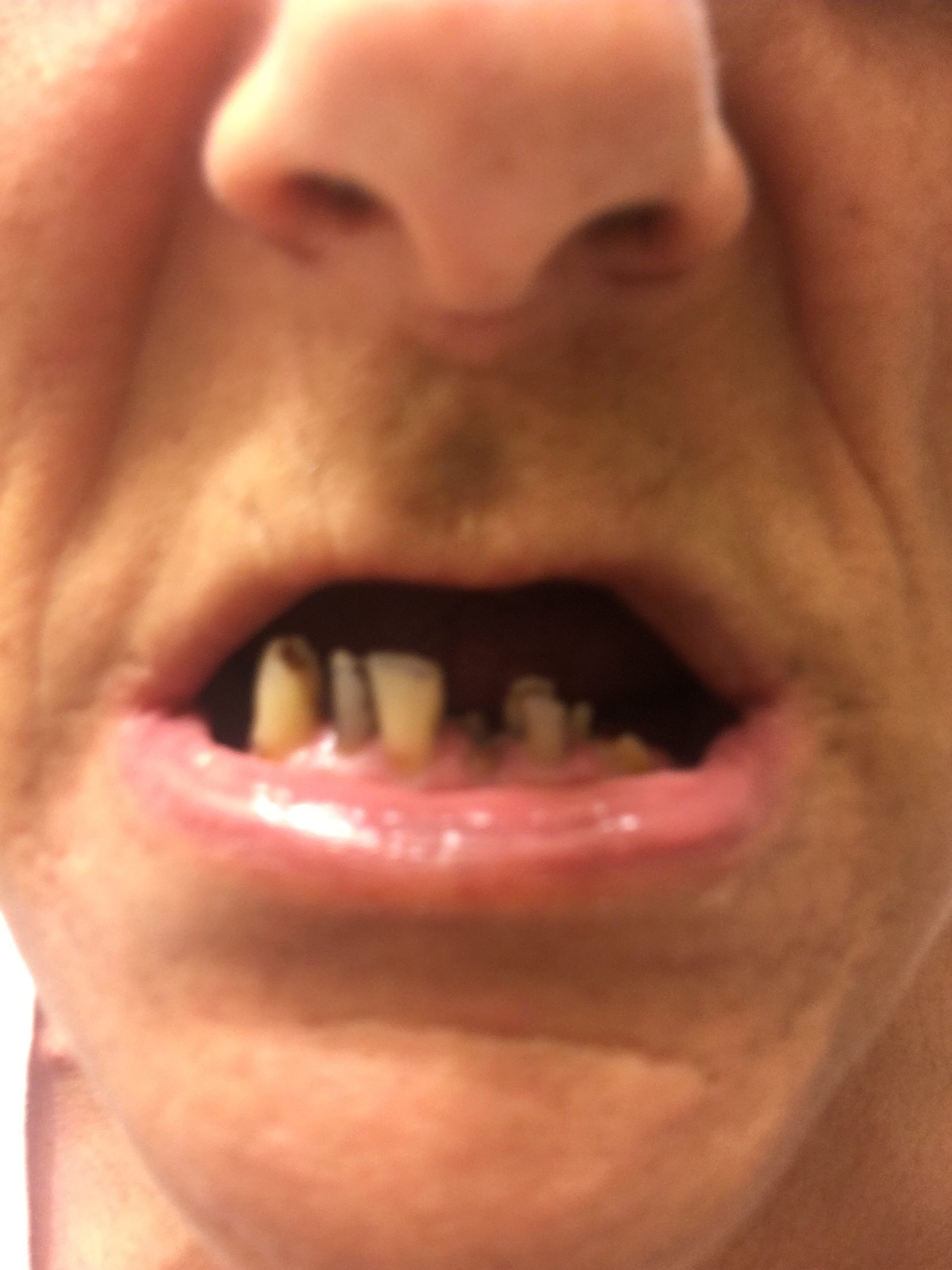 Top 565 Complaints and Reviews about Aspen Dental