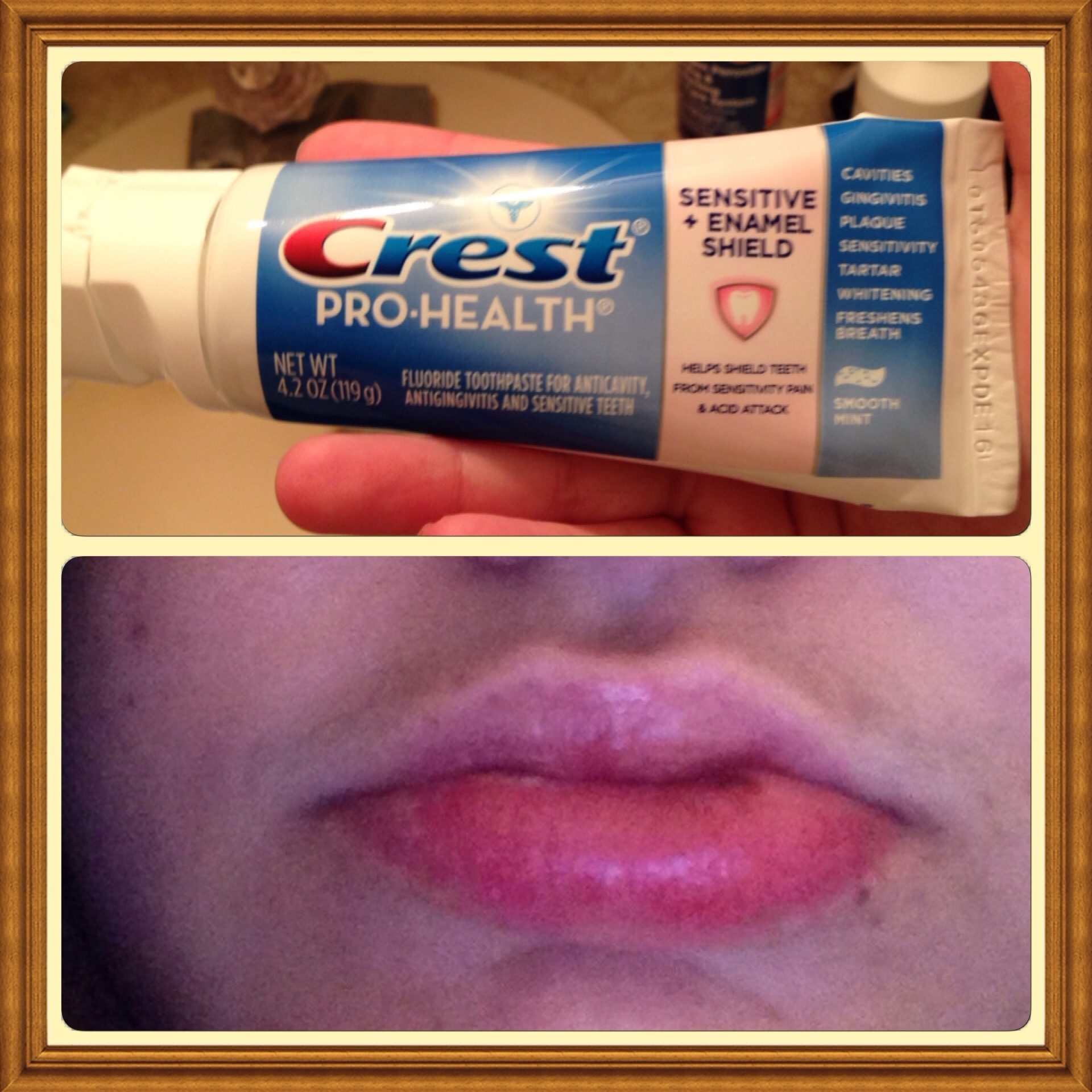 Top 764 Complaints and Reviews about Crest Toothpaste Page 4