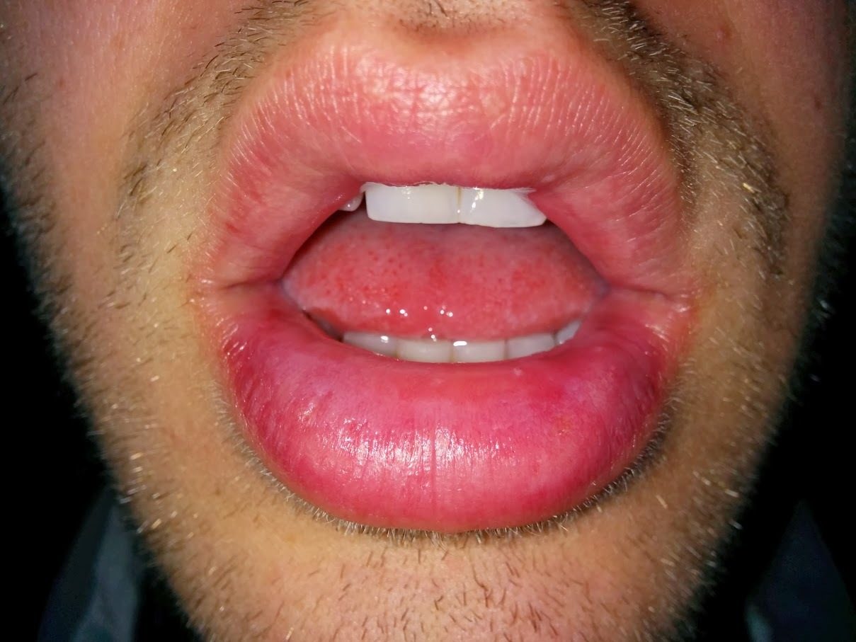 Top 769 Complaints and Reviews about Crest Toothpaste Page 9