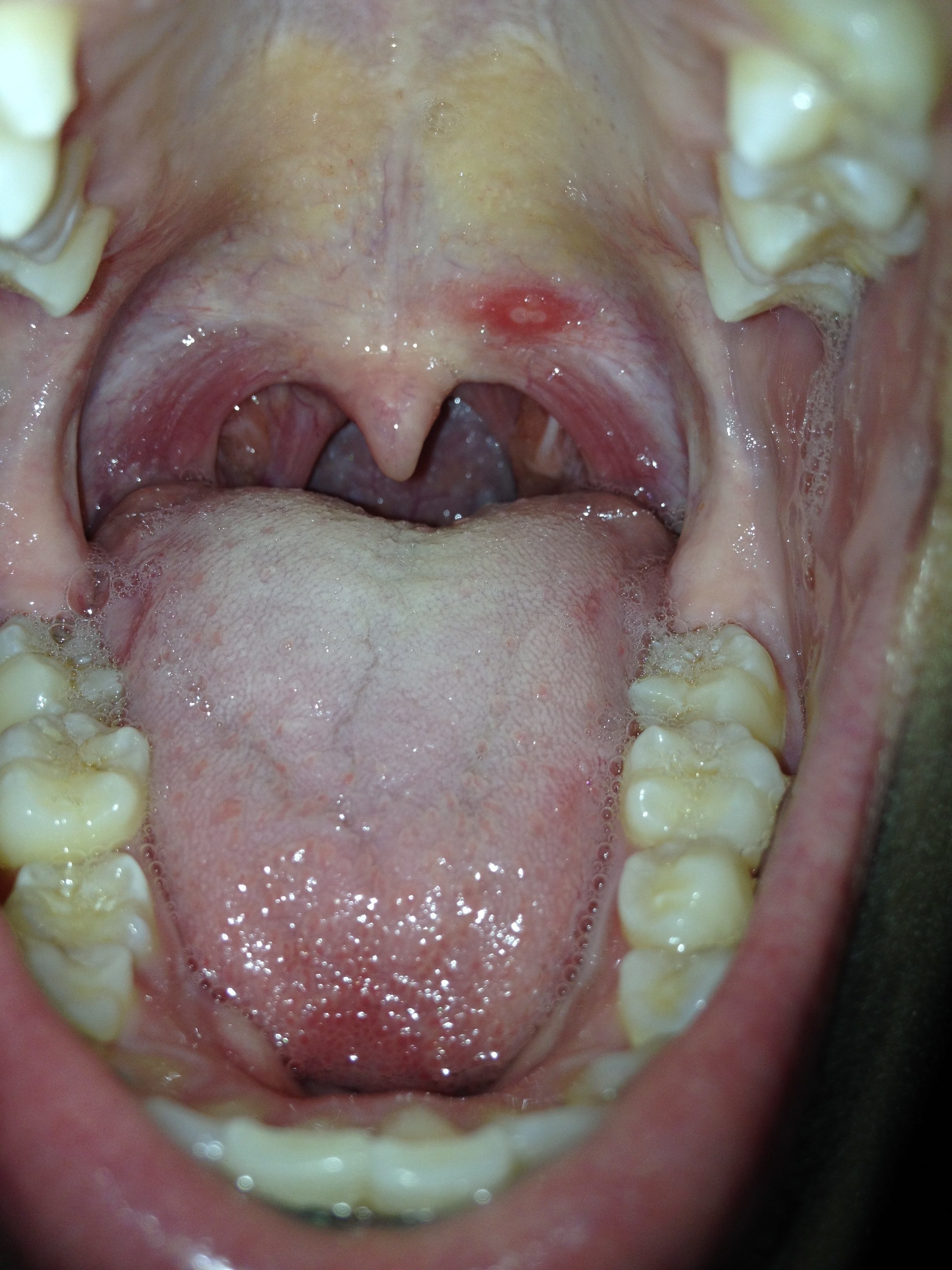 Top 777 Complaints and Reviews about Crest Toothpaste Page 9