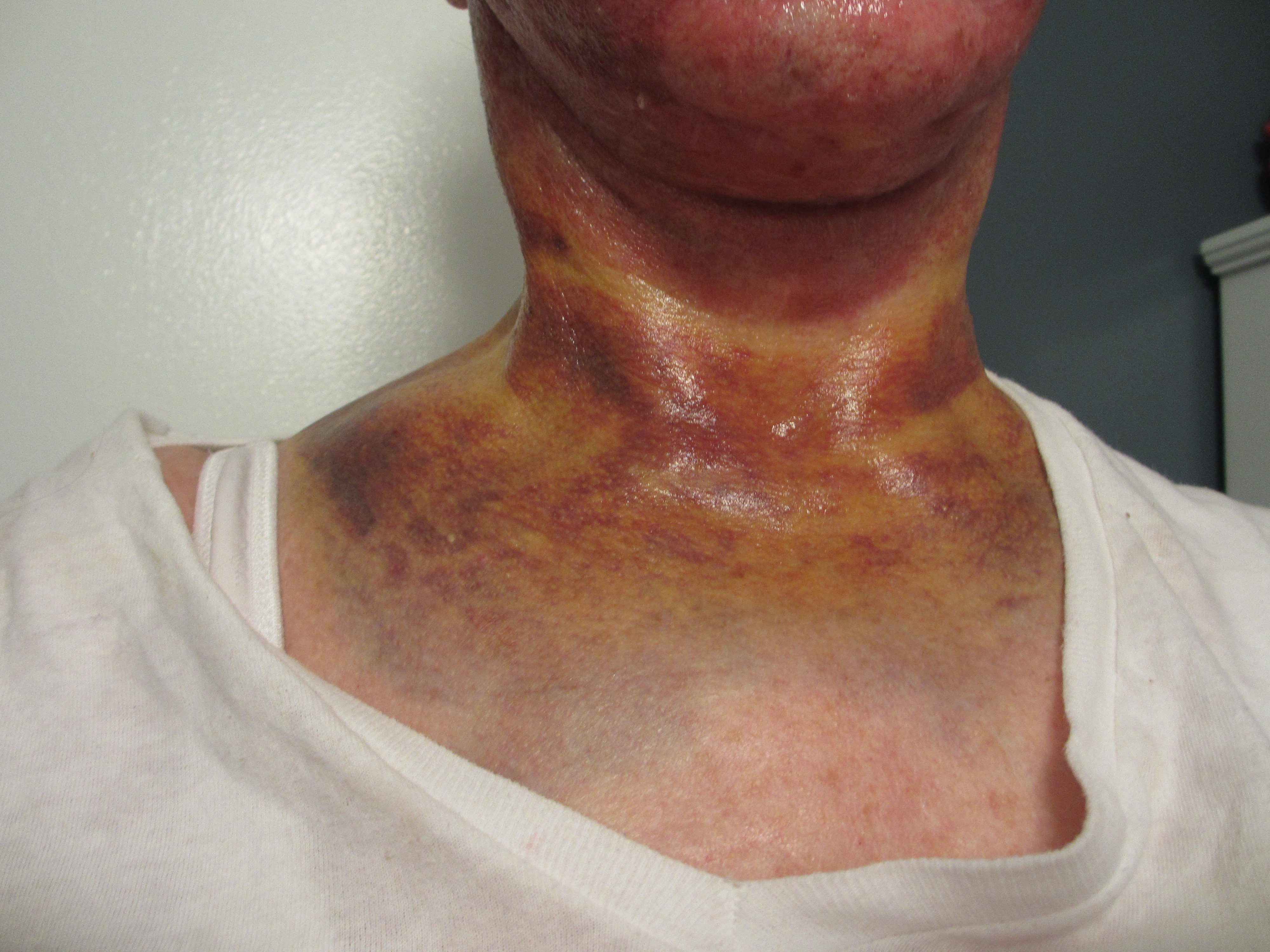 Top 300 Complaints and Reviews about Lifestyle Lift | Page 4