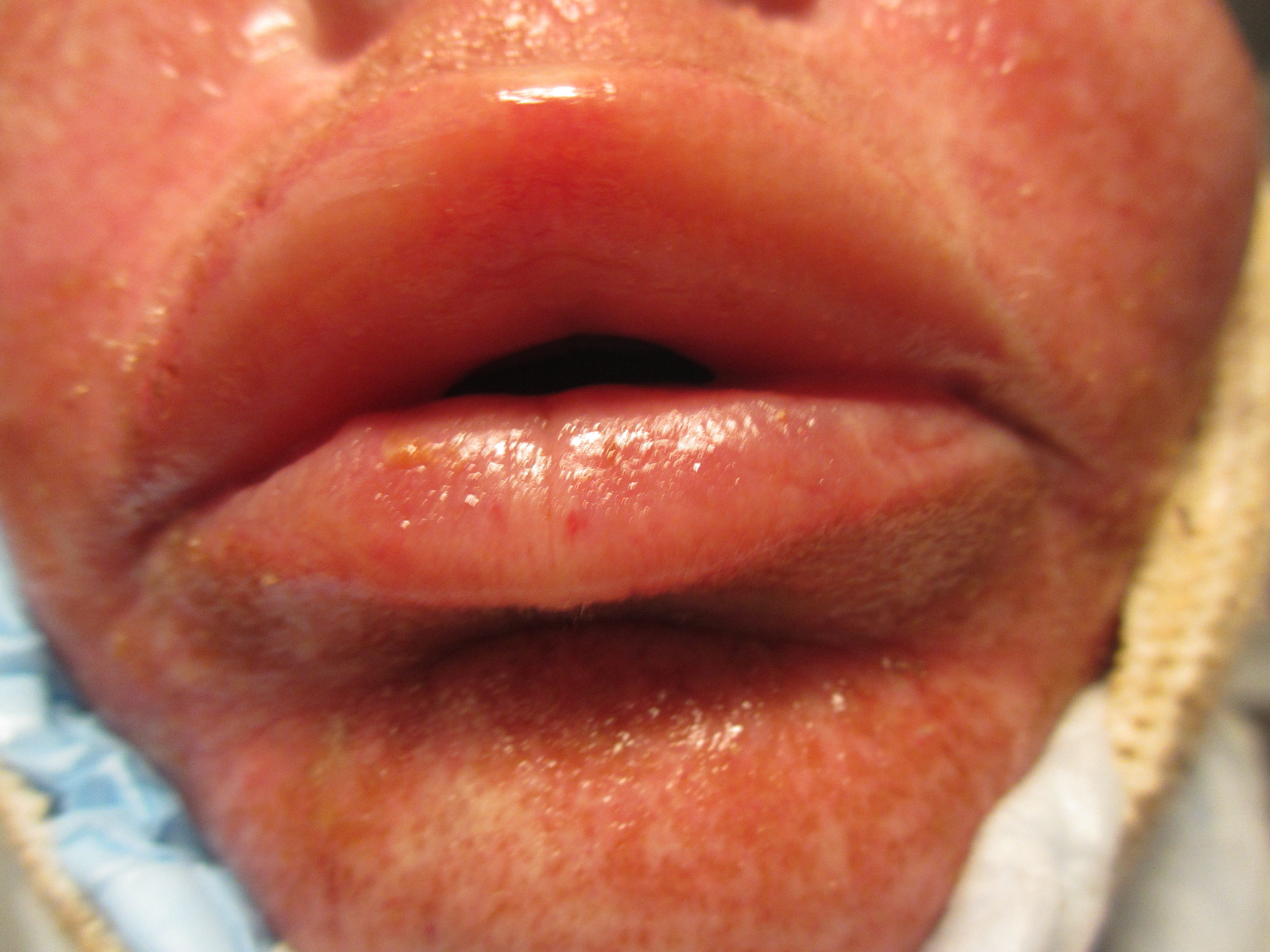 Top 301 Complaints and Reviews about Lifestyle Lift | Page 4