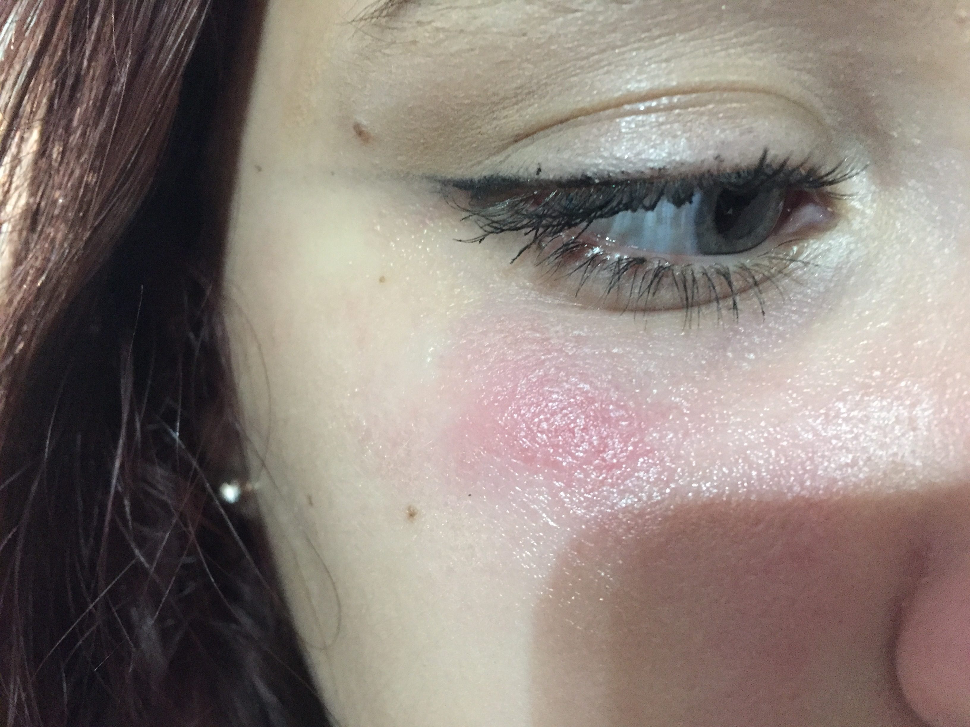 Allergic Reaction To Makeup Rash Saubhaya Makeup