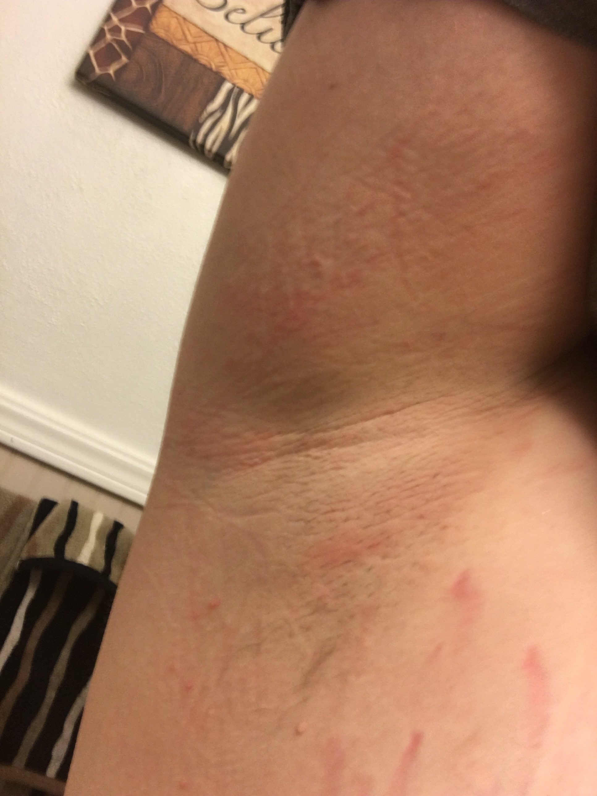 old spice chemical burn old spice chemical burn