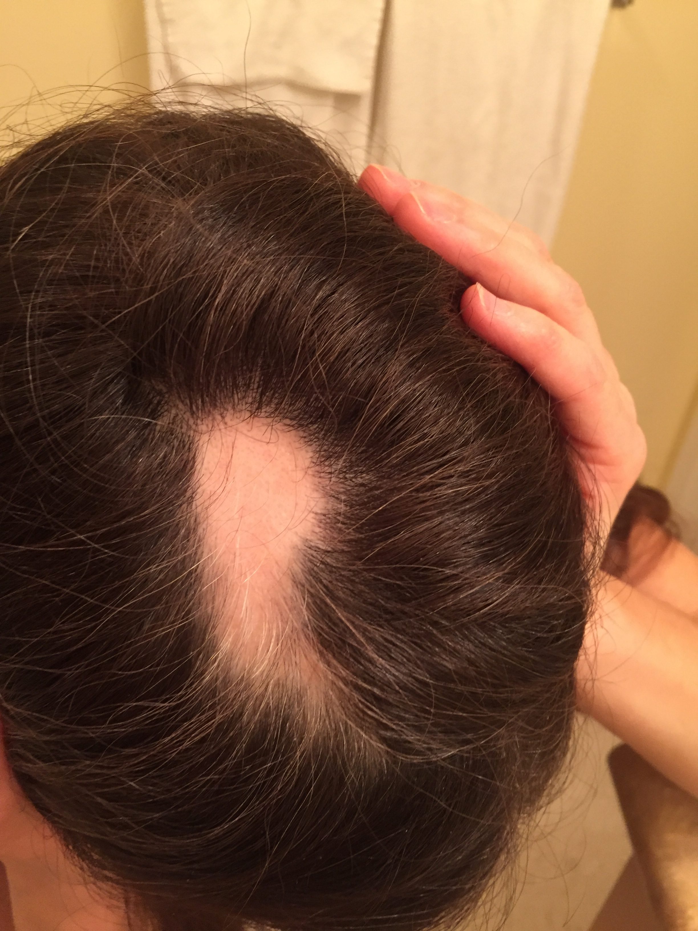 Why Hair Loss With Wen Trendy Hairstyles In The USA